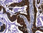 PGAM2 Polyclonal Antibody