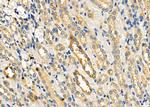 PTGES Polyclonal Antibody