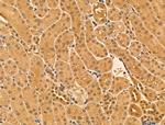 PHF20L1 Antibody in Immunohistochemistry (Paraffin) (IHC (P))