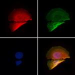 PHF3 Polyclonal Antibody