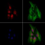 PHOX2B Polyclonal Antibody