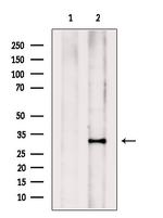PHOX2B Antibody in Western Blot (WB)