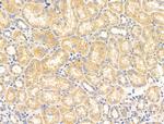 CALM Polyclonal Antibody