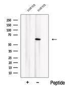 PIP5K1B Polyclonal Antibody