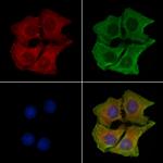 PIP5K1C Polyclonal Antibody