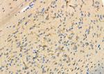 PKA C alpha/beta Antibody in Immunohistochemistry (Paraffin) (IHC (P))