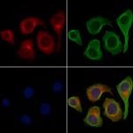 PKC delta Polyclonal Antibody