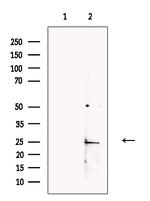 CSH2 Polyclonal Antibody