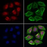 PLCB1 Polyclonal Antibody