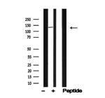 PLCB3 Antibody in Western Blot (WB)