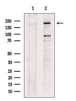 PLXND1 Polyclonal Antibody