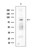 PNPase Antibody in Western Blot (WB)