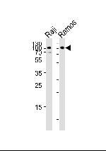 CD19 Antibody in Western Blot (WB)