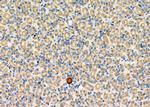 PPA1 Polyclonal Antibody