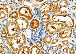 PPP2R2A Polyclonal Antibody
