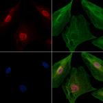 PPP2R5C Polyclonal Antibody