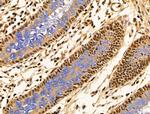 PPP2R5C Antibody in Immunohistochemistry (Paraffin) (IHC (P))