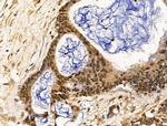 PPP2R5C Antibody in Immunohistochemistry (Paraffin) (IHC (P))