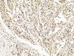 PPP2R5C Antibody in Immunohistochemistry (Paraffin) (IHC (P))