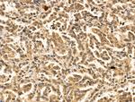 PPP2R5C Antibody in Immunohistochemistry (Paraffin) (IHC (P))