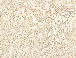 PRDM2 Antibody in Immunohistochemistry (Paraffin) (IHC (P))