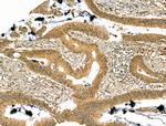 PREP Antibody in Immunohistochemistry (Paraffin) (IHC (P))