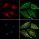 PSMA4 Polyclonal Antibody