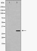PSMA4 Antibody in Western Blot (WB)