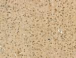 PU.1 Antibody in Immunohistochemistry (Paraffin) (IHC (P))