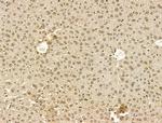 PU.1 Antibody in Immunohistochemistry (Paraffin) (IHC (P))