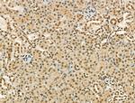 PU.1 Antibody in Immunohistochemistry (Paraffin) (IHC (P))