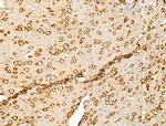 PURA Polyclonal Antibody
