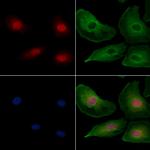 PYGO2 Polyclonal Antibody