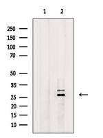 RAB29 Polyclonal Antibody