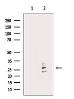 RAB29 Polyclonal Antibody
