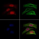 RACGAP1 Polyclonal Antibody