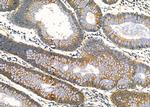 RARRES3 Antibody in Immunohistochemistry (Paraffin) (IHC (P))
