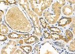 RARRES3 Polyclonal Antibody