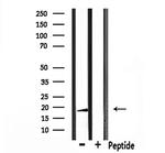 RARRES3 Antibody in Western Blot (WB)