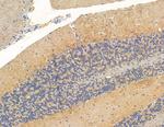 RASA4 Antibody in Immunohistochemistry (Paraffin) (IHC (P))