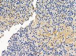 RASGRF2 Polyclonal Antibody