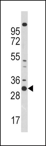 CDK1 Antibody in Western Blot (WB)
