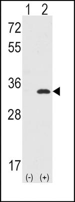 CDK1 Antibody in Western Blot (WB)