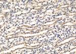 RBPMS Polyclonal Antibody