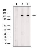RB1 Polyclonal Antibody
