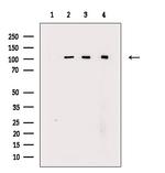 RB1 Antibody in Western Blot (WB)