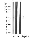 RARA/RARB Polyclonal Antibody