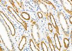 ARHGAP28 Polyclonal Antibody