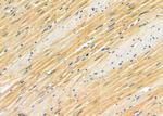 ARHGAP28 Antibody in Immunohistochemistry (Paraffin) (IHC (P))