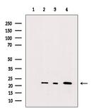 RHOA Polyclonal Antibody